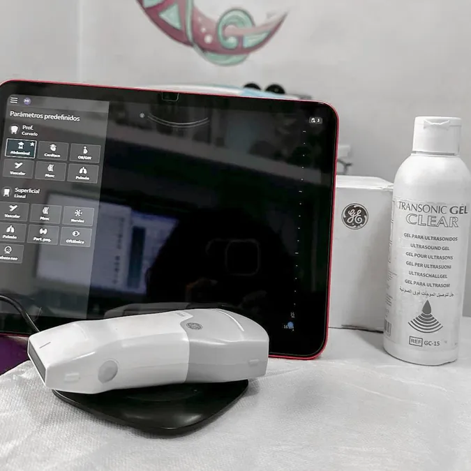 Ecografía VScan Air SL — diagnóstico por imagen en fisioterapia